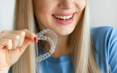 Aligner Theraphie