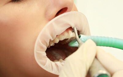 Prophylaxe
